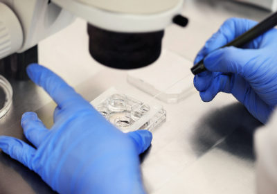 A process of artificial insemination of an egg in an IVF clinic.
