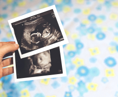 Unresolved debate about abortion: Abuse of language
