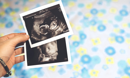 Unresolved debate about abortion: Abuse of language