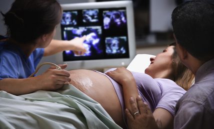Texas midwife, associates first to be charged under state's abortion ban